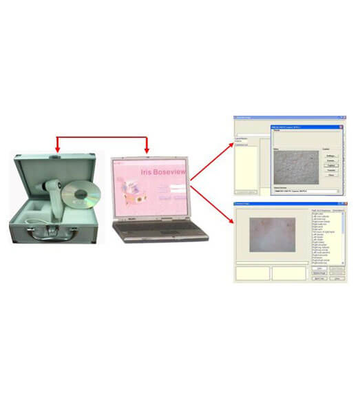 Máy soi da và tóc kết nối vi tính 6100U Máy soi da và tóc kết nối vi tính 6100U